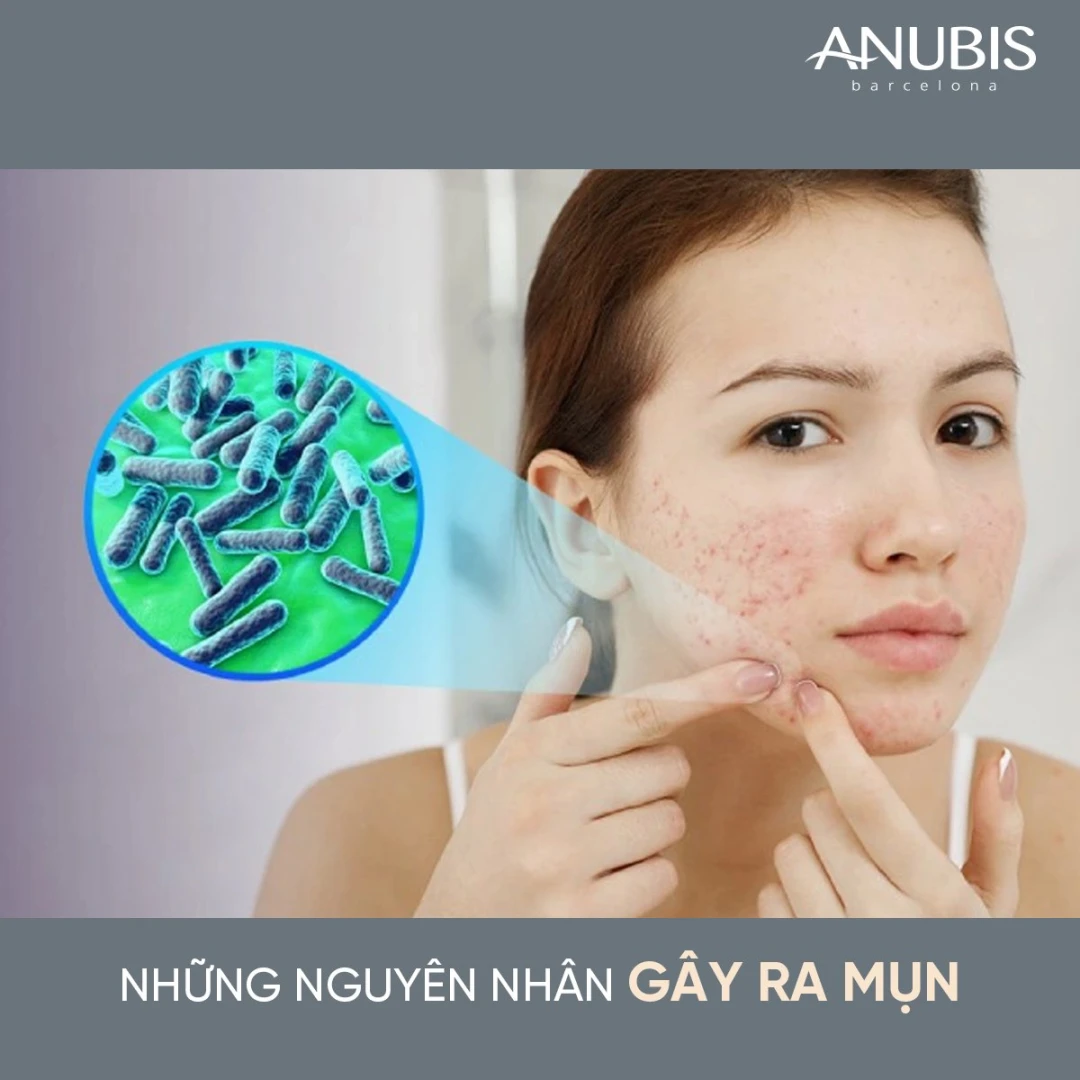 Những nguyên nhân gây ra mụn