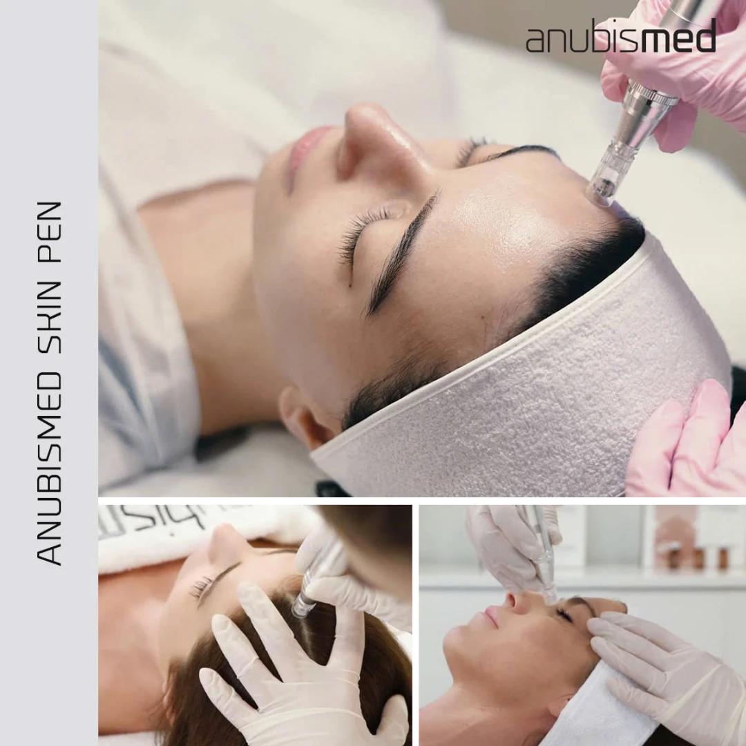 Head replacements AnubisMed Skin Pen